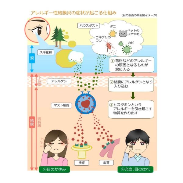 アレルギーの季節がやってきました!アレジオンクリームで花粉症対策を!